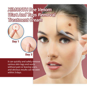 Crema de Tratamiento para Verrugas con Veneno de Abeja Ximonth, Suaviza la Piel, Reduce las Manchas Oscuras y los Pápulas Faciales, Limpia y Trata Suavemente las Verrugas - Product Image 3
