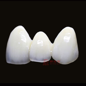 Laboratorio dentale eccellente precisione protesi fisse utilizzando materiale ceramico Zirconia porcellane tutte le corone e ponte in ceramica - Product Image 2