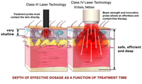 2025 haute puissance classe 4 thérapie laser dispositif vétérinaire soulagement de la douleur des tissus profonds équipement de physiothérapie