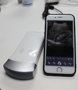 Wifi Wireless B/W Ultrasound <strong>Convex</strong> <strong>Probe</strong> with Android System, <strong>Handheld</strong> <strong>Mini</strong> Site-rite Ultrasonic Scanner for Abdomen - Product Image 4