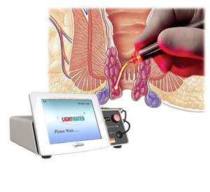 Precio competitivo portátil 1470nm 980nm diodo láser hemorroidectomía equipo de cirugía para fístula anal tratamiento de <span class=keywords><strong>hemorroides</strong></span> - Product Image 1