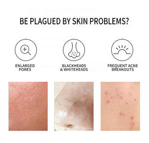 แผ่นมาส์กหน้ากรดซาลิไซลิกแบบแผ่นสำลี โลโก้สั่งทำ ควบคุมความมัน ทำความสะอาดล้ำลึก กระชับรูขุมขน บรรเทาอา<span class=keywords><strong>การ</strong></span>ระคายเคือง สำหรับผิวเป็นสิวง่าย - Product Image 5