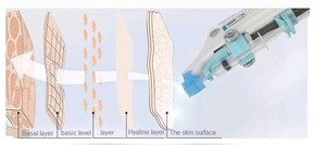 Mesogun terapi hidrasi dalam, sangat efektif Mesotherapy melembabkan dalam untuk mencerahkan warna kulit - Product Image 6