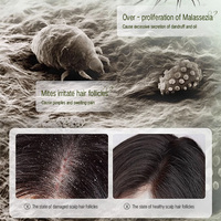 Sampo Rambut Peptide Pengontrol Minyak Label Pribadi Anti-ketombe Pembersih Mendalam Pemurni Menutrisi Perawatan Rambut