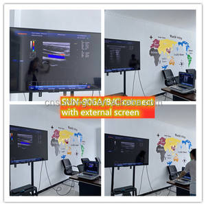 Mesin <span class=keywords><strong>Ultrasound</strong></span> Doppler warna portabel, pemasok produsen 3D <span class=keywords><strong>4D</strong></span> kualitas tinggi perangkat <span class=keywords><strong>Ultrasound</strong></span> - Product Image 2