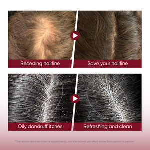 แชมพูและครีมนวดผมที่ช่วยให้ผมร่วงปราศจากซัลเฟตสินค้าตรา OEM - Product Image 5