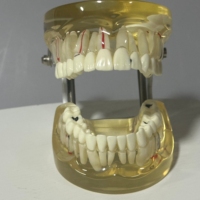 Modèle Typodont dentaire Standard pour l'étude de la maladie d'implant de pont de restauration de dents démo médicale amovible pour dentiste