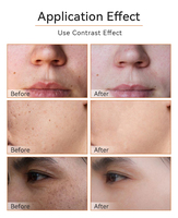 Sérum et Crème Visage Anti-Acné et Éclaircissant au Curcuma et Vitamine C, Faible MOQ, Marque Privée, pour Tous Types de Peaux - OEM/ODM