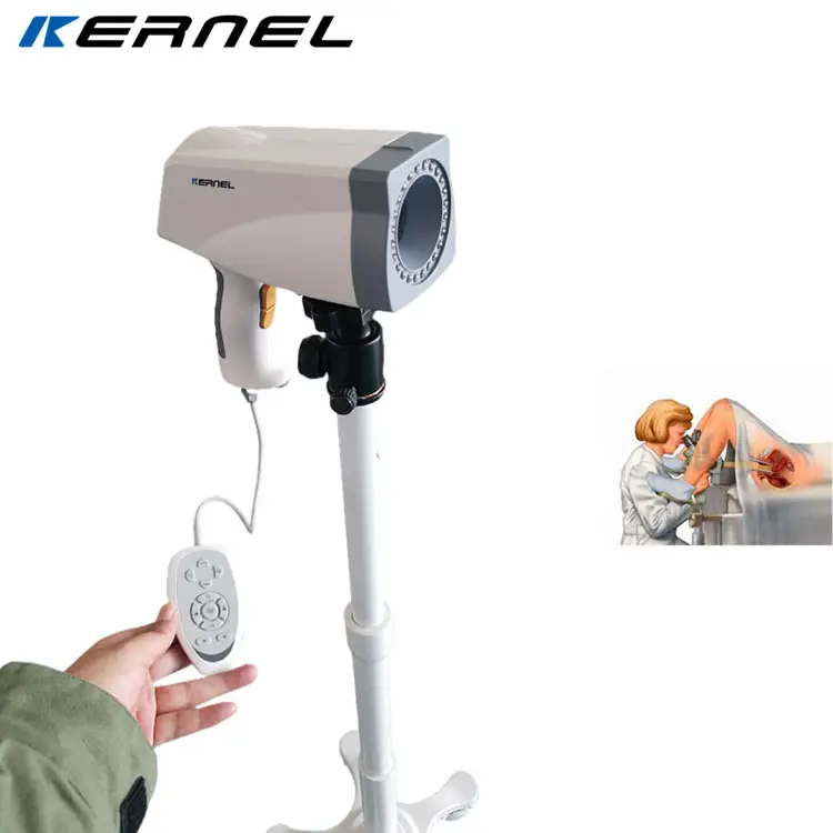 CE утвержденный цифровой кольпоскоп видеокольпоскоп портативный оптический кольпоскоп для гинекологического осмотра