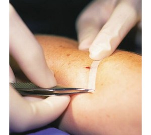 Hysent bán buôn steri-dải băng dính ít đăng vô trùng vết thương da đóng băng liền mạch - Product Image 5