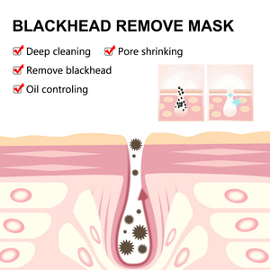 Masques faciaux anti-points noirs au charbon de bambou pour le nez, soin de la peau du visage, outils de beauté anti-acné et anti-imperfections - Product Image 3