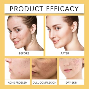 น้ำมันหอมระเหยจากพืช 100% ผสมโคจิกและกรดไฮยาลูโรนิก กลิ่นหอมสดชื่น ช่วยลดสิว ลดรอยแผลเป็น น้ำมันขมิ้นเพื่อผิวกระจ่างใส - Product Image 6