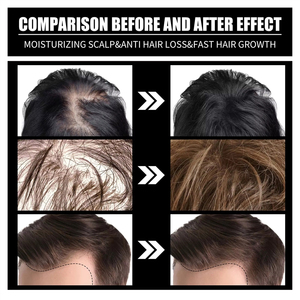 Nouveauté : Huile Essentielle Bio au Collagène et Vitamine B7 pour la Croissance, le Renforcement et la Prévention de la Casse des Cheveux, Adaptée à Tous Types de Cheveux - Product Image 5