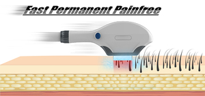 <span class=keywords><strong>2025</strong></span> mới xử lý Elight IPL <span class=keywords><strong>SHR</strong></span> không đau Máy tẩy lông Beauty Salon thiết bị CE được phê duyệt với IPL RF Elight - Product Image 5