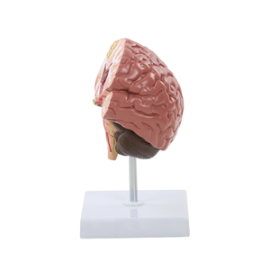 Modelo de Cerebro Humano con <span class=keywords><strong>Derrame</strong></span> Cerebral - Modelo Anatómico de Enfermedad Cerebral Patológica - Hemorragia Cerebral - Lesión Cerebral - Product Image 4