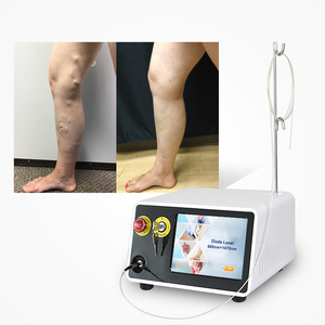 Dispositivo de Tratamiento Láser Endovascular 360 Redial Fiber 1470nm para Venas Varicosas, 980nm para Eliminación de Arañas Vasculares y <span class=keywords><strong>Varices</strong></span> EVLT - Product Image 1
