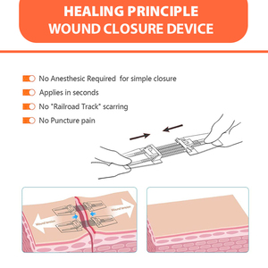Cinta Adhesiva Estéril para Primeros Auxilios, Apósito Quirúrgico Transparente, Tira Adhesiva Estéril para Reparación <span class=keywords><strong>de</strong></span> la Piel, para Uso en el Hogar y al Aire Libre - Product Image 5