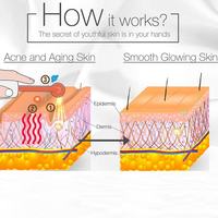 Appareil de massage facial portable à haute fréquence, baguette à électrodes, thérapie pour la peau et les cheveux, éliminateur de points noirs, traitement de l'acné, beauté à domicile, salon de beauté