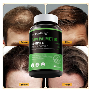 Oem Odm <span class=keywords><strong>Pastillas</strong></span> <span class=keywords><strong>para</strong></span> el crecimiento del cabello Suplemento <span class=keywords><strong>de</strong></span> proteína Biotina Pérdida <span class=keywords><strong>de</strong></span> cabello Vitamina Booster Colágeno Saw Palmetto Complex Cápsulas <span class=keywords><strong>de</strong></span> polipéptido - Product Image 1