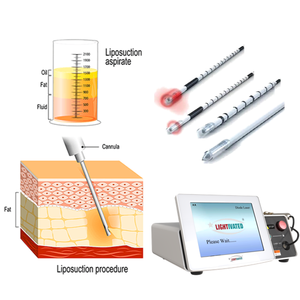 980nm 1470nm Diode Laser Fiber Endolaser Resserrement de la peau du corps et dispositif de levage du visage Liposuccion et lipolyse Machine Consommables - Product Image 6