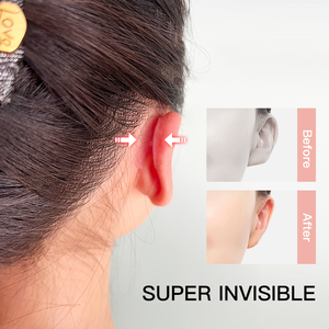 <span class=keywords><strong>Corrector</strong></span> <span class=keywords><strong>de</strong></span> <span class=keywords><strong>Orejas</strong></span> para Adultos YuMeBeauty, Paquete al por Mayor, <span class=keywords><strong>Corrector</strong></span> Estético Cosmético Impermeable para <span class=keywords><strong>Orejas</strong></span> Prominentes - Product Image 4
