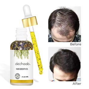 Dechaab produk pertumbuhan rambut cepat Serum pertumbuhan rambut botak minyak jarak alami Rosemary pertumbuhan rambut untuk pria - Product Image 3