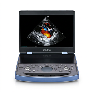 Máquina de Ultrasonido Doppler a Color Veterinaria Mindray Vetus E7 para Diagnóstico por Imágenes en Animales, Uso en Hospitales Veterinarios - Product Image 1