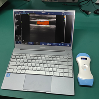 Sonda de Ultrasonido Inalámbrica 3 en 1 JM-5CPL, Escáner Portátil Doppler a Color, Sonda Convexa, Lineal y de Fase, para Uso Médico y Veterinario