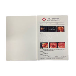 14x17 lazer <span class=keywords><strong>x-ray</strong></span> filmi <span class=keywords><strong>FUJI</strong></span> DI-HL (14X17 ") / (35x43cm) tıbbi lazer filmi <span class=keywords><strong>Fuji</strong></span> kuru <span class=keywords><strong>Film</strong></span> - Product Image 3