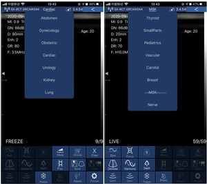 Échographe vétérinaire portable sans fil couleur Doppler B26 à usage général avec sondes convexe, linéaire et cardiaque 192 éléments - Product Image 4