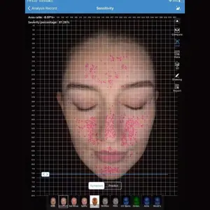 Analyseur de peau portable MC10 Machine d'analyse de la peau du visage Équipement de beauté Équipement facial Analyseur de scanner de peau