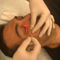 Lifting facial Endolaser 1470nm Vaser Laser Liposuccion Chirurgie plastique Machine de beauté laser Endo Laser Lift