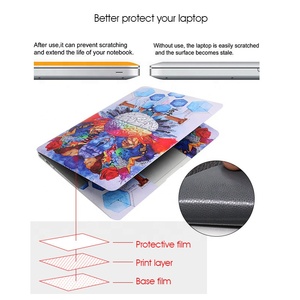 Miếng Dán Máy Tính Xách Tay Thiết Kế Não Miếng Dán Bảo Vệ 11 13.3 14 15 15.6 17Inch Cho Hp Samsung Dell Apple Acer 2023 - Product Image 3