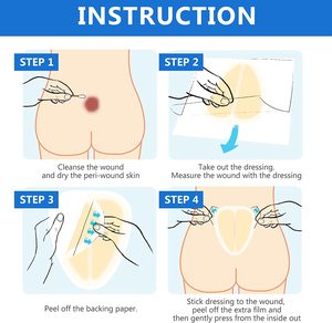 <span class=keywords><strong>แผ่น</strong></span>ปิดแผลไฮโดรคอลลอยด์บางพิเศษดูดซับได้ดี<span class=keywords><strong>แผ่น</strong></span>เจลสำหรับการรักษาอย่างรวดเร็วทนน้ำ - Product Image 6