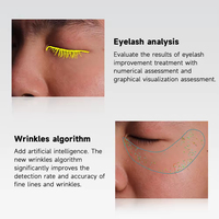 Dermatoscope numérique 3D portable avec IA, analyseur de peau, appareil d'analyse de la peau avec lumière UV pour les spas et les salons de beauté