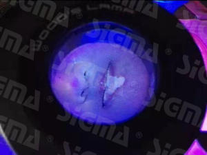 시그마 SW-10 디지털 피부경 검사기 휴대용 피부 검사 도구 (임상 피부과용) - Product Image 4