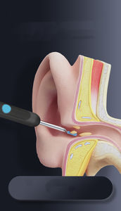Otoscopio Inteligente con Cámara, Herramienta para Remover Cera, Limpiador de Oídos con Mini Cámara, Cuidado de la Salud - Product Image 6