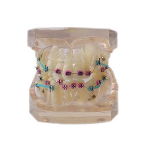 Modèle de dents dentaires/modèle orthodontique <span class=keywords><strong>dentaire</strong></span> avec supports métalliques - Product Image 4