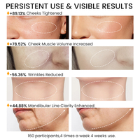 Masajeador Facial 3D Giratorio para Moldear el Cuerpo, Reducción de Celulitis, Drenaje Linfático, Desintoxicación Facial, Relajante, Dispositivo de Belleza Multifunción