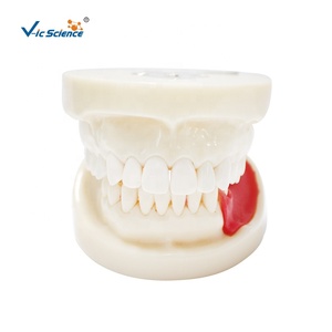 Modelo de entrenamiento Typodont, modelo de mandíbula de práctica de <span class=keywords><strong>implantes</strong></span> <span class=keywords><strong>dentales</strong></span>, modelo de dientes humanos, modelo de educación de Ciencias Médicas - Product Image 1