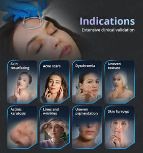 Beste Leverancier Van Schoonheidsapparatuur Hoge Sterkte Draagbare <span class=keywords><strong>Co2</strong></span> <span class=keywords><strong>Laser</strong></span> Medische Vaginale Aanscherping 40W Lasermachine Ons - Product Image 6