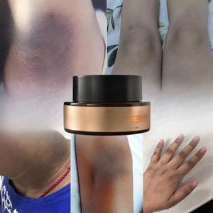 Crème Blanchissante OEM 8 Jours <span class=keywords><strong>pour</strong></span> Zones Intimes, Maillot, <span class=keywords><strong>Aisselles</strong></span> et Parties Privées, Éclaircissant <span class=keywords><strong>pour</strong></span> Genoux Sombres et Peau Sensible - Product Image 2