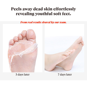 <span class=keywords><strong>Masque</strong></span> exfoliant pour <span class=keywords><strong>les</strong></span> <span class=keywords><strong>pieds</strong></span> à marque privée, <span class=keywords><strong>masque</strong></span> exfoliant pour <span class=keywords><strong>les</strong></span> <span class=keywords><strong>pieds</strong></span> - Product Image 3
