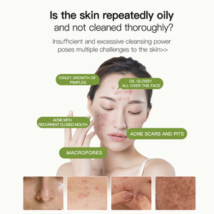 โทนเนอร์บำรุงผิวหน้าจากต้นชา icesea สำหรับผิวมันและผิวที่มีปัญหาสิวการควบคุมน้ำมันลดสิวลดรูขุมขนตามธรรมชาติ100% - Product Image 3