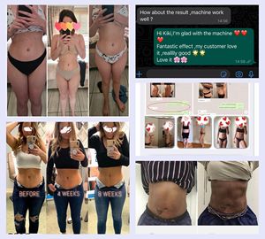 Elettrostimolatore Brucia Grassi Dimagrante EMS TENS Stimolatore Muscolare EMS Attrezzatura per Modellamento del Corpo e Bellezza - Product Image 4