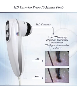 Máquina Analizadora de Cuero Cabelludo HD Multilingüe de Alta Calidad para el Análisis de Problemas Capilares - Product Image 3