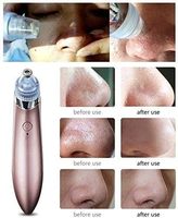Dissolvant de points noirs aspirateur de pores nettoyeur de pores du visage électrique acné ventouse acné bouton extracteur