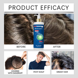 Champú para Hombre con Extracto Natural de Menta para una Limpieza Profunda y Control de Grasa <span class=keywords><strong>en</strong></span> <span class=keywords><strong>el</strong></span> <span class=keywords><strong>Cuero</strong></span> <span class=keywords><strong>Cabelludo</strong></span> Graso, Apto para Uso Diario - Product Image 5