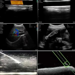 Ecografo Portatile Wireless B, Strumento Diagnostico Veterinario in ABS, Sonda 3.2/5.0MHz per Maiali e Pecore, Compatibile con Android/iOS/Windows - Product Image 3