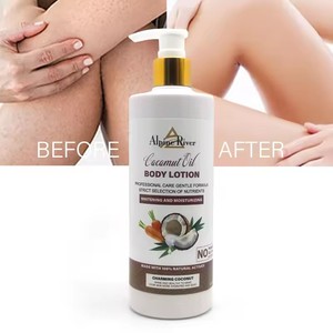 Crème blanchissante rapide pour les peaux foncées Kojic Sen Lotion corporelle hydratante et éclaircissante Soins de la peau pour un teint impeccable - Product Image 3